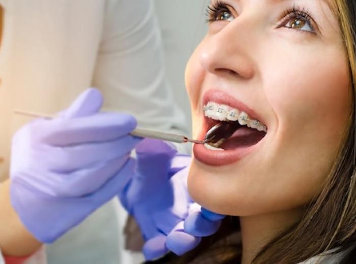 The Straight Path to Health: Why Aligned Teeth are Easier to Keep Cavity-Free