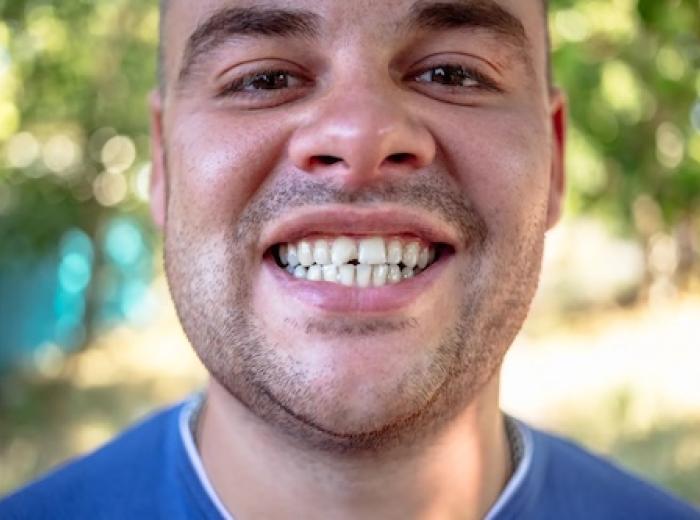 Urgent Relief in Shelby Township: Immediate Triage for Cracked Teeth and Pain